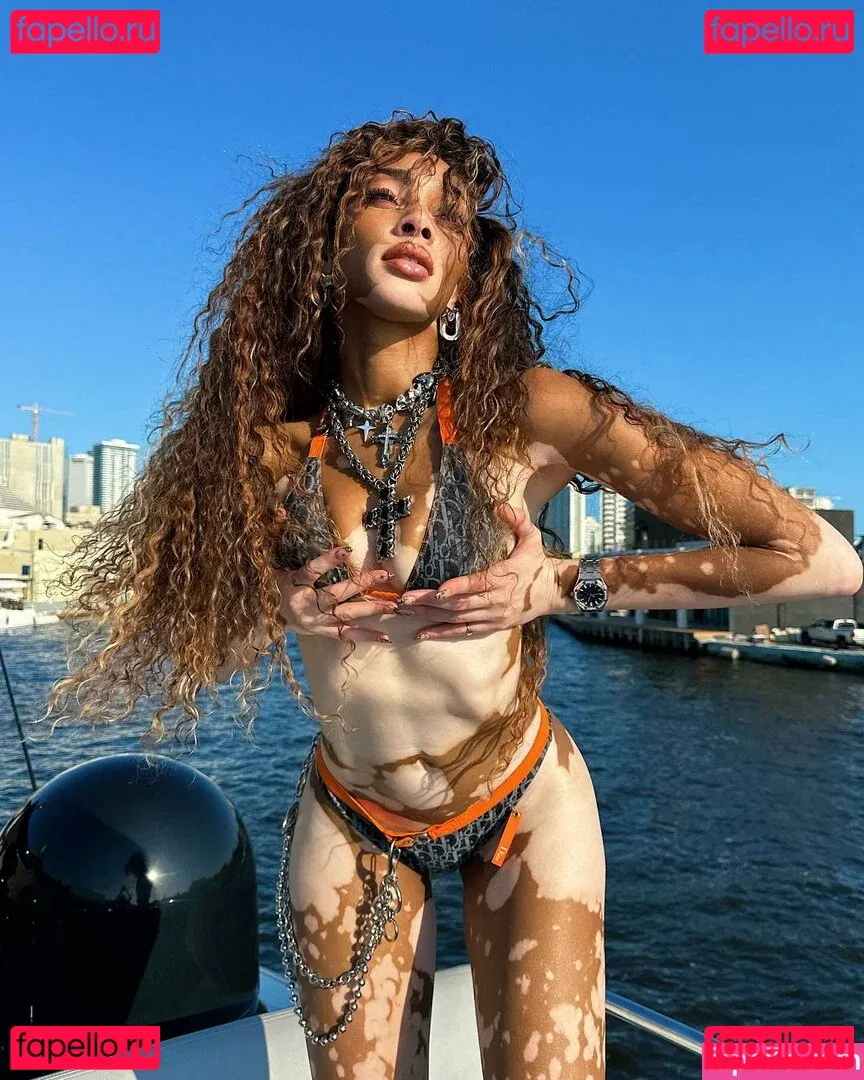 Winnie Harlow Onlyfans Photo Gallery 