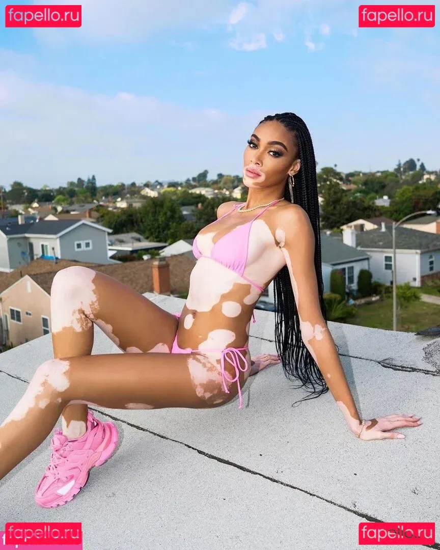 Winnie Harlow Onlyfans Photo Gallery 