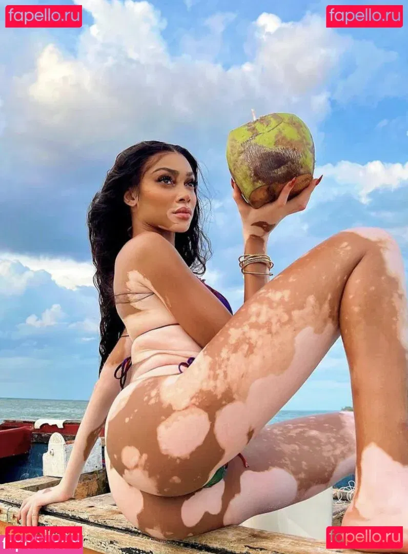 Winnie Harlow Onlyfans Photo Gallery 