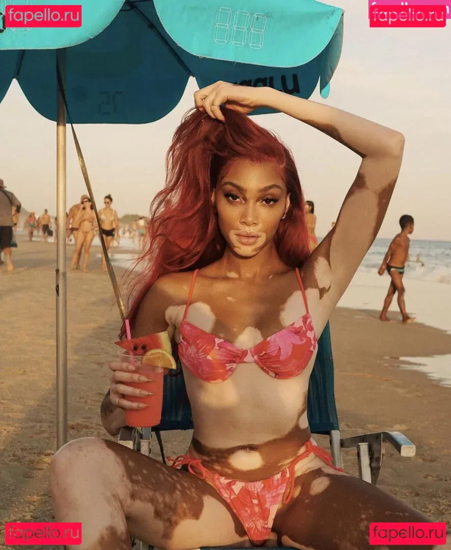 Winnie Harlow Onlyfans Photo Gallery 