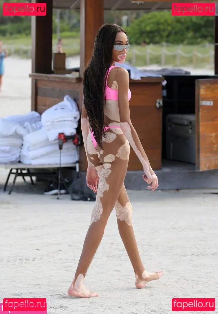 Winnie Harlow Onlyfans Photo Gallery 