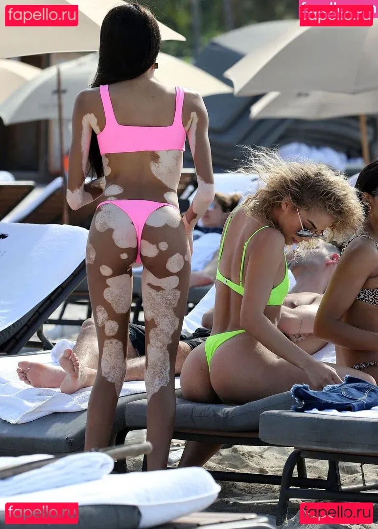 Winnie Harlow Onlyfans Photo Gallery 