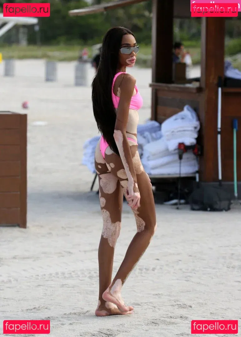 Winnie Harlow Onlyfans Photo Gallery 