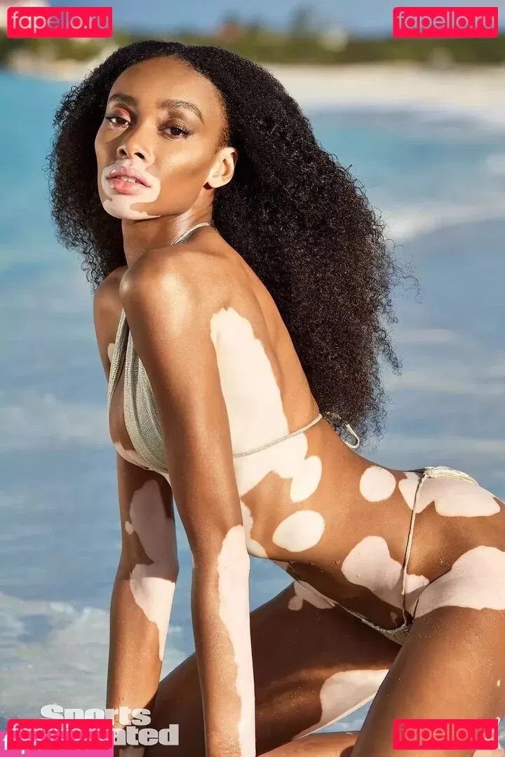 Winnie Harlow Onlyfans Photo Gallery 
