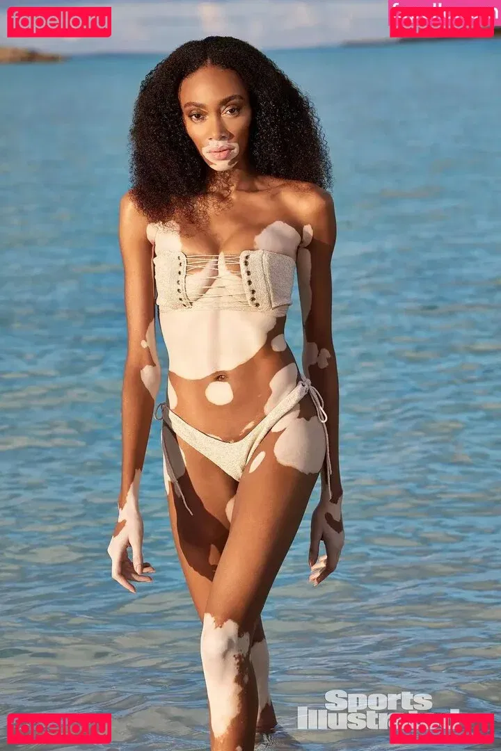 Winnie Harlow Onlyfans Photo Gallery 