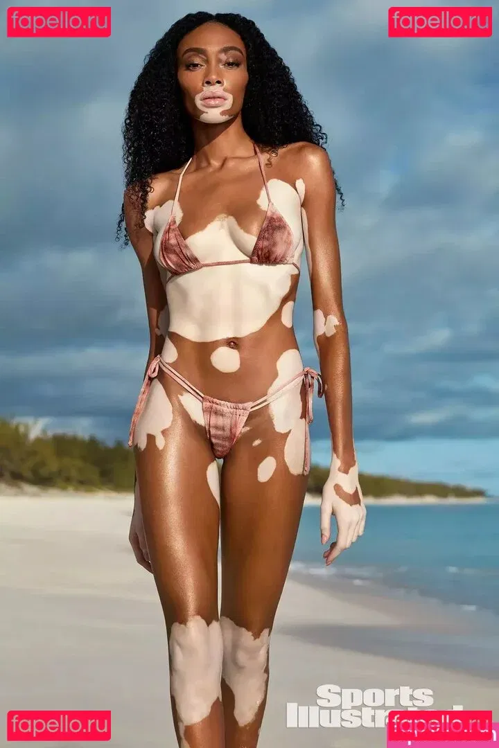 Winnie Harlow Onlyfans Photo Gallery 