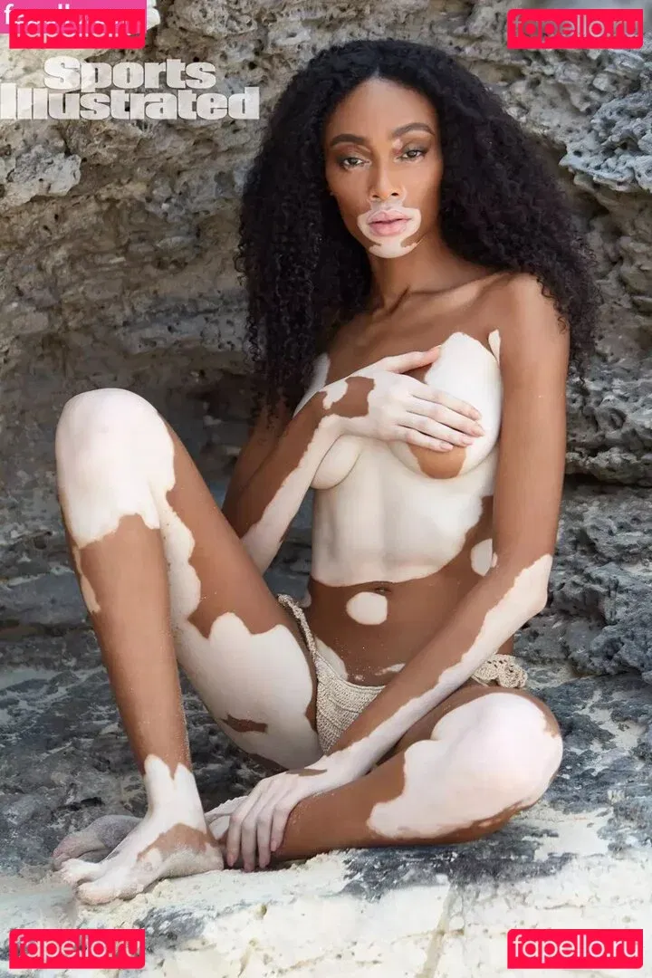 Winnie Harlow Onlyfans Photo Gallery 