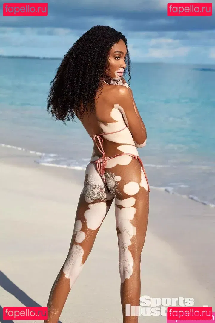 Winnie Harlow Onlyfans Photo Gallery 