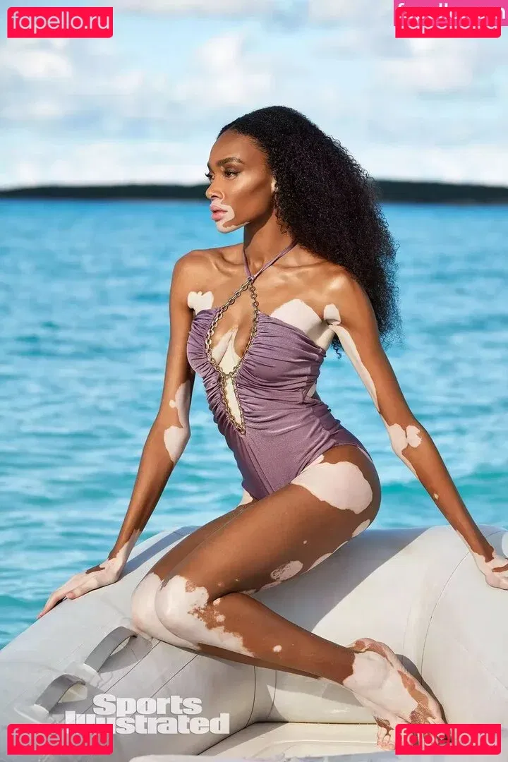 Winnie Harlow Onlyfans Photo Gallery 