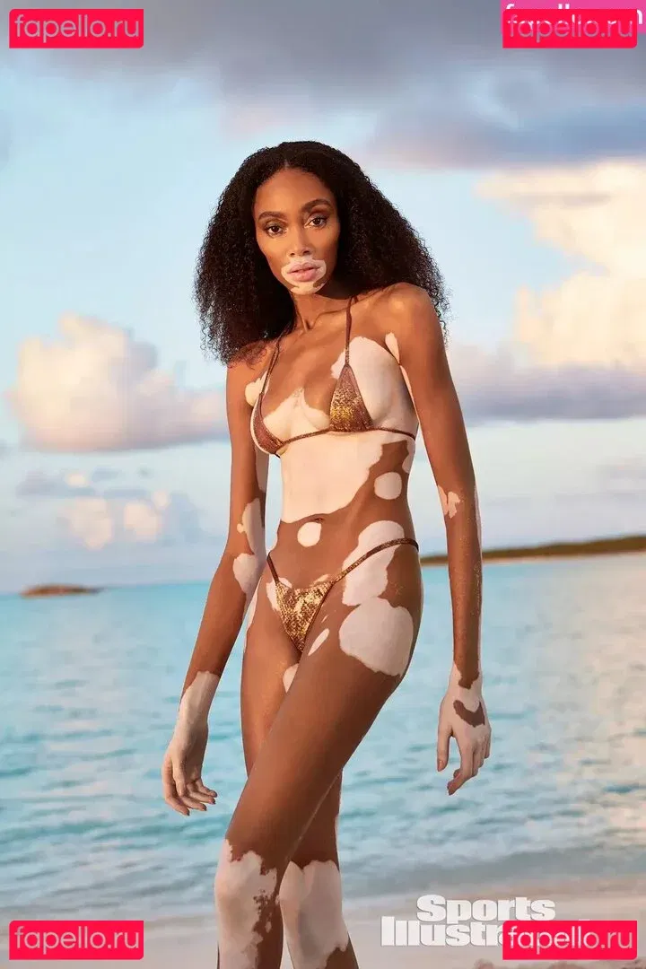 Winnie Harlow Onlyfans Photo Gallery 