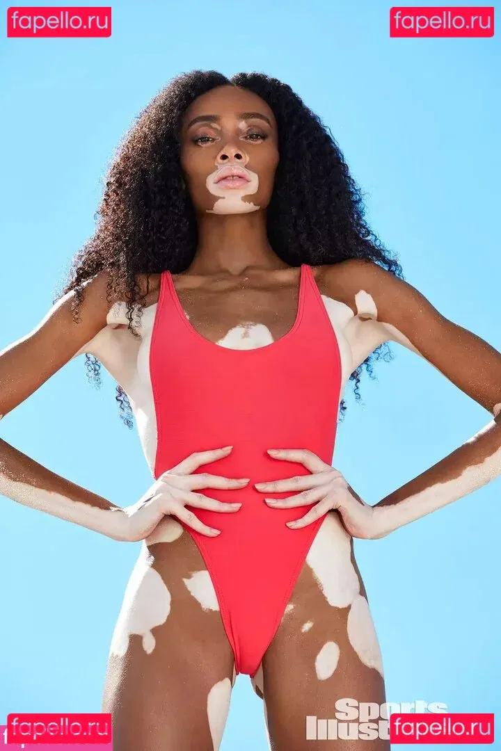 Winnie Harlow Onlyfans Photo Gallery 