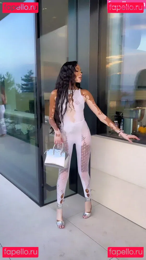 Winnie Harlow Onlyfans Photo Gallery 