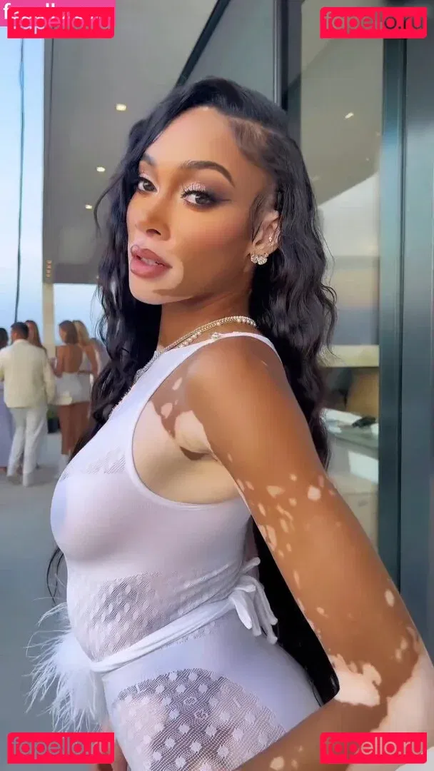 Winnie Harlow Onlyfans Photo Gallery 