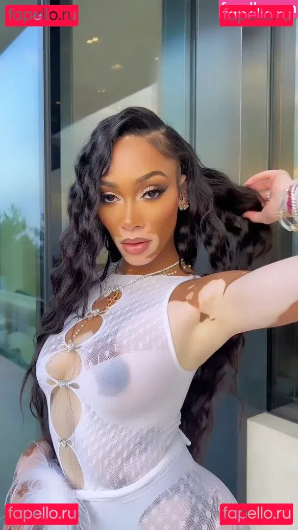 Winnie Harlow Onlyfans Photo Gallery 