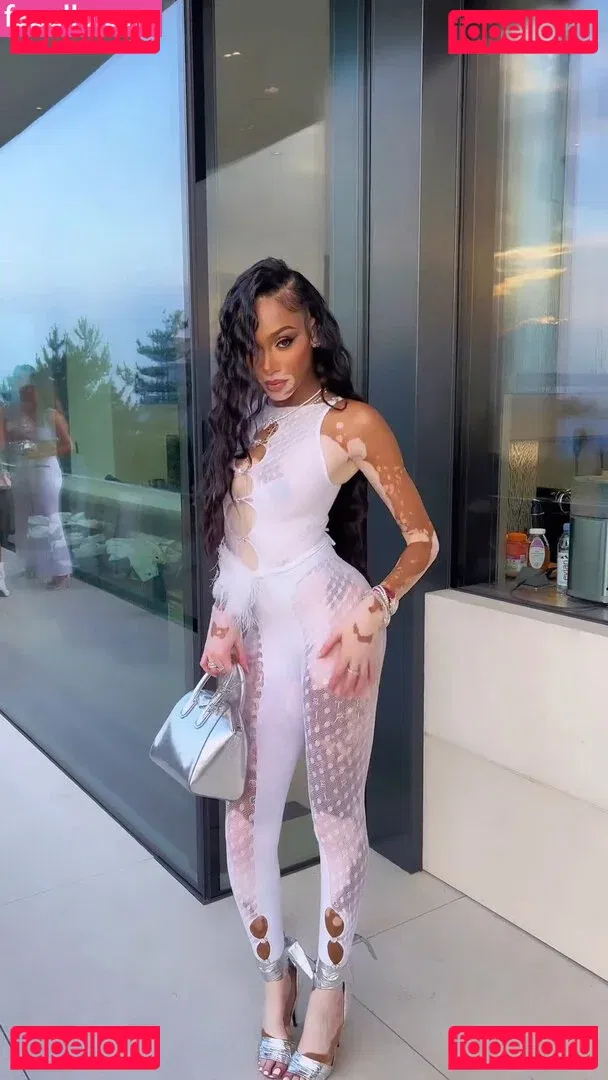 Winnie Harlow Onlyfans Photo Gallery 