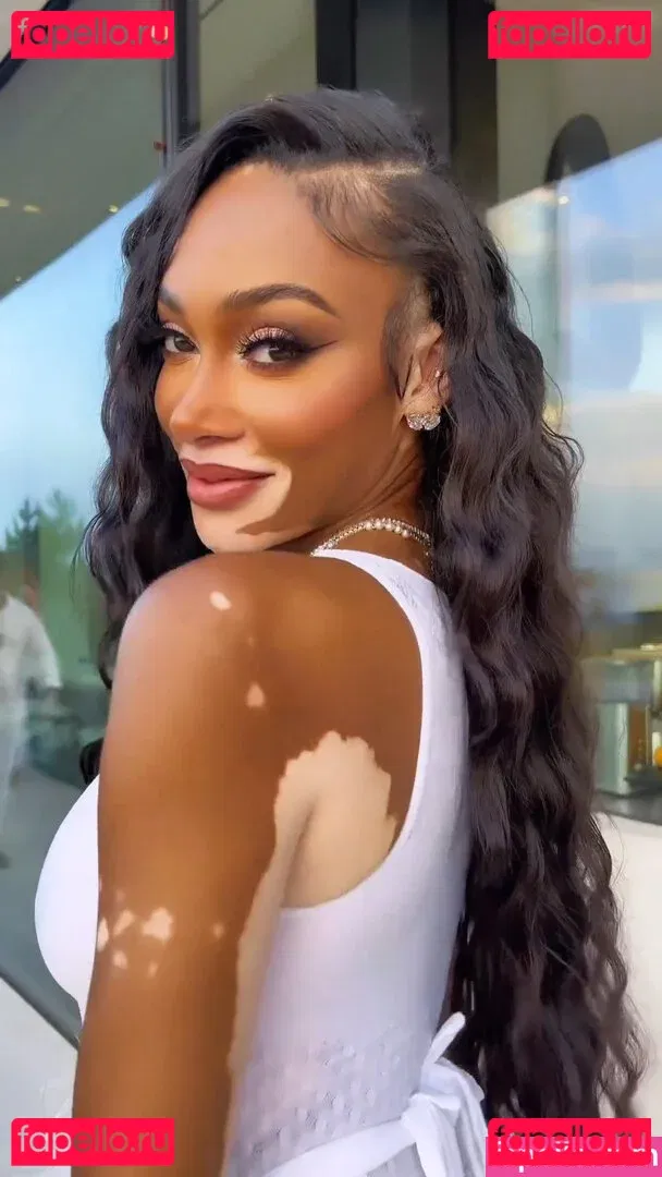 Winnie Harlow Onlyfans Photo Gallery 