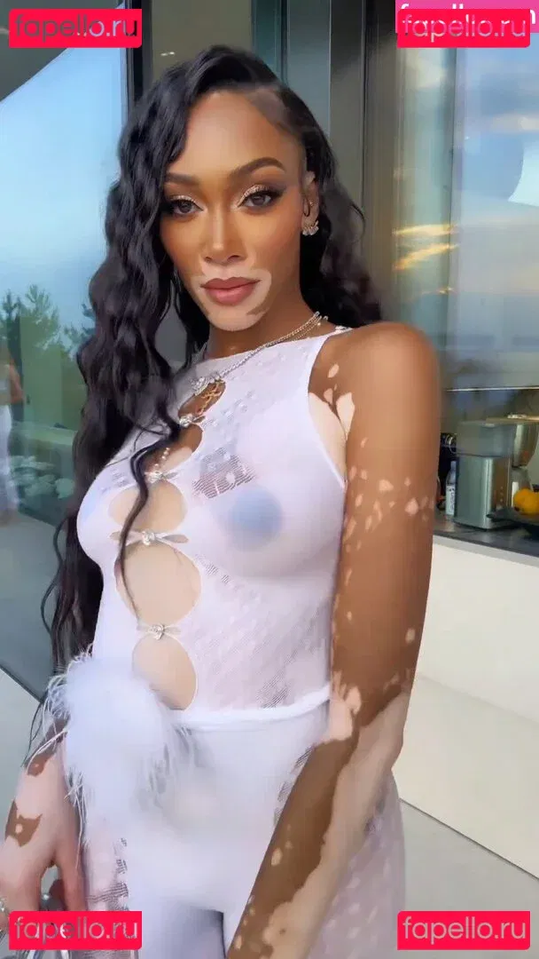 Winnie Harlow Onlyfans Photo Gallery 