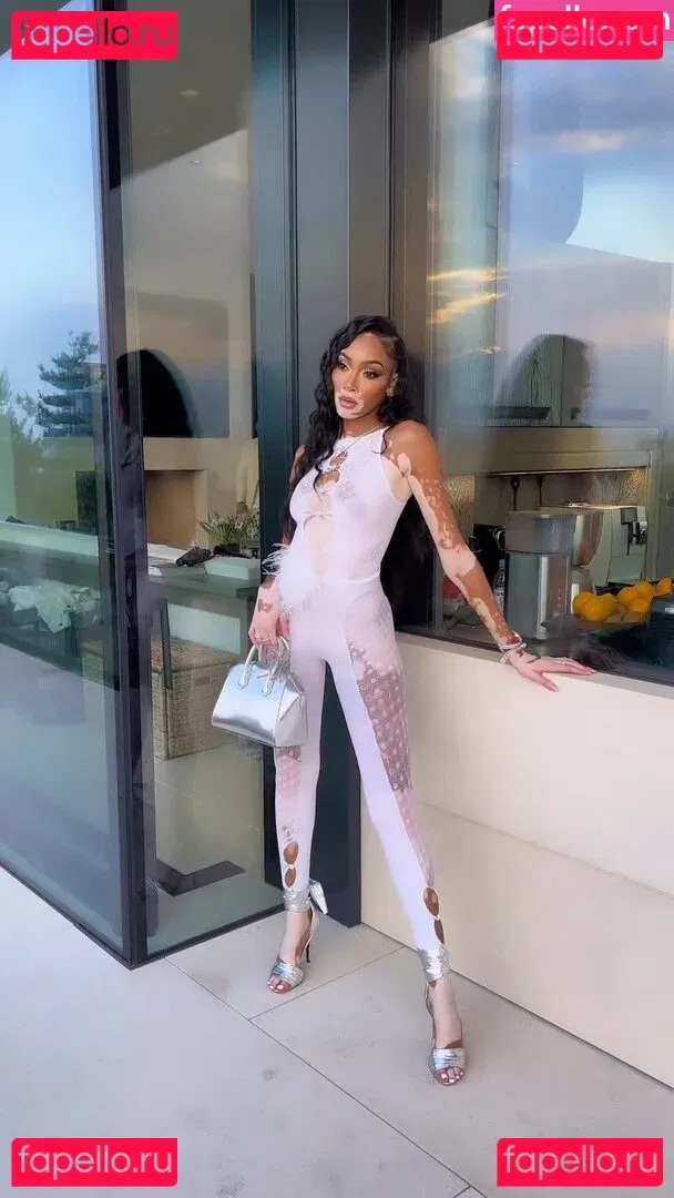 Winnie Harlow Onlyfans Photo Gallery 