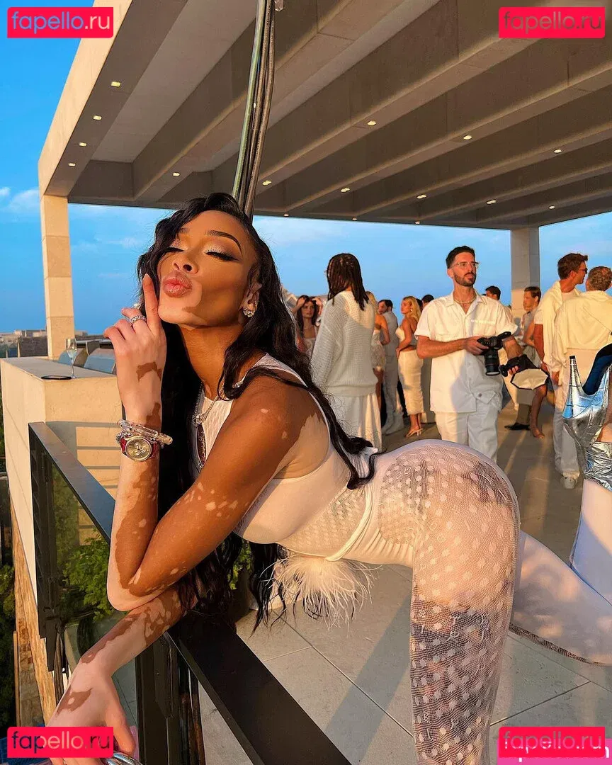 Winnie Harlow Onlyfans Photo Gallery 