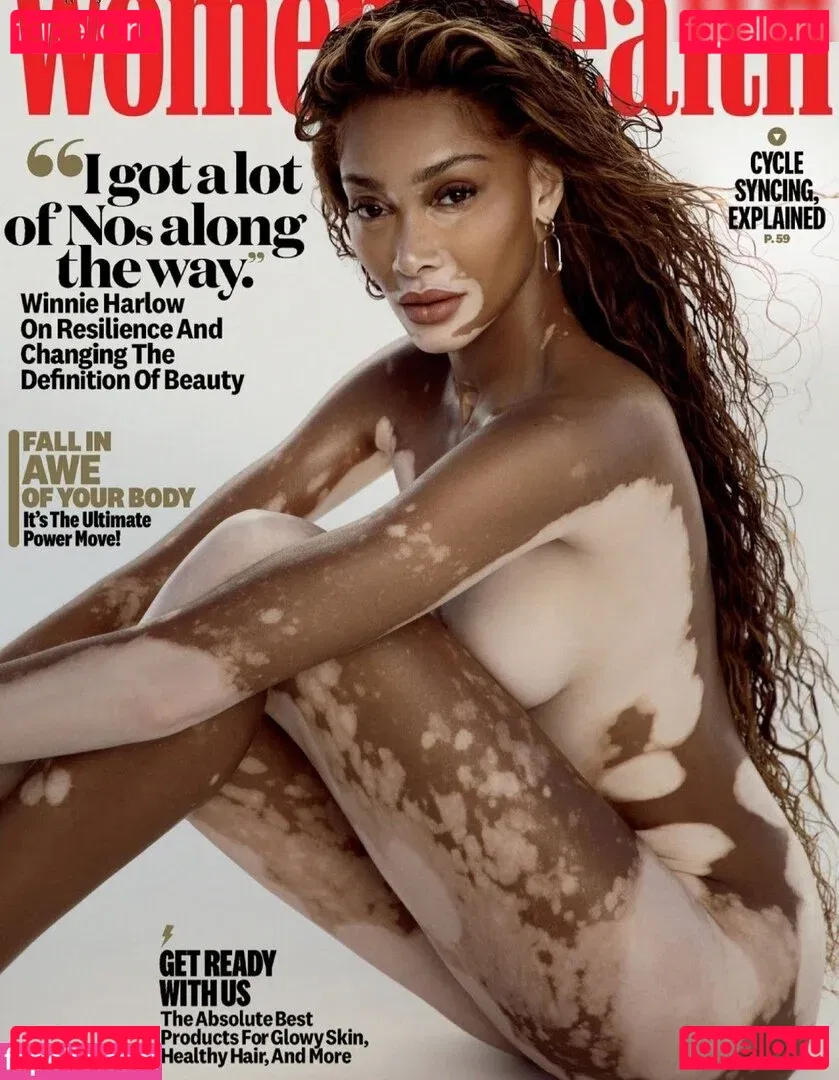 Winnie Harlow Onlyfans Photo Gallery 