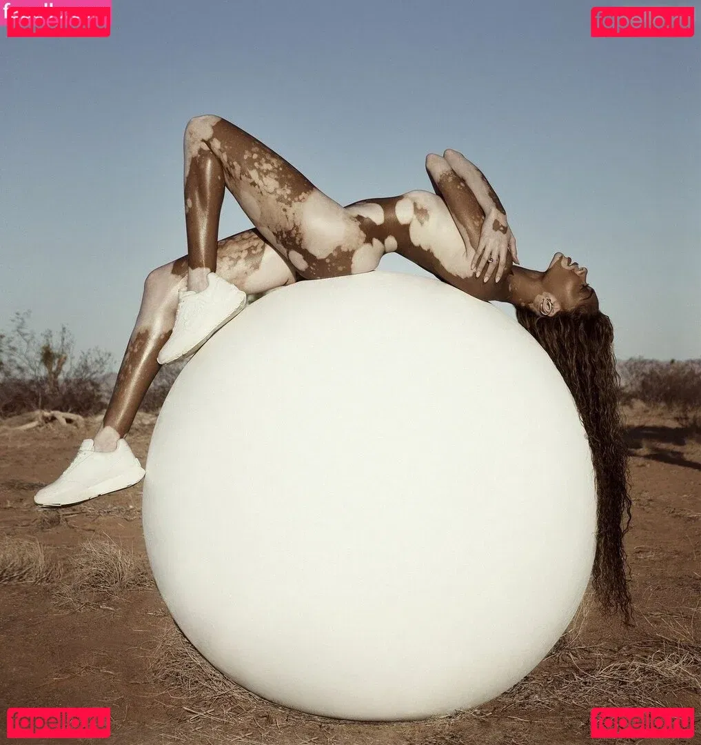 Winnie Harlow Onlyfans Photo Gallery 