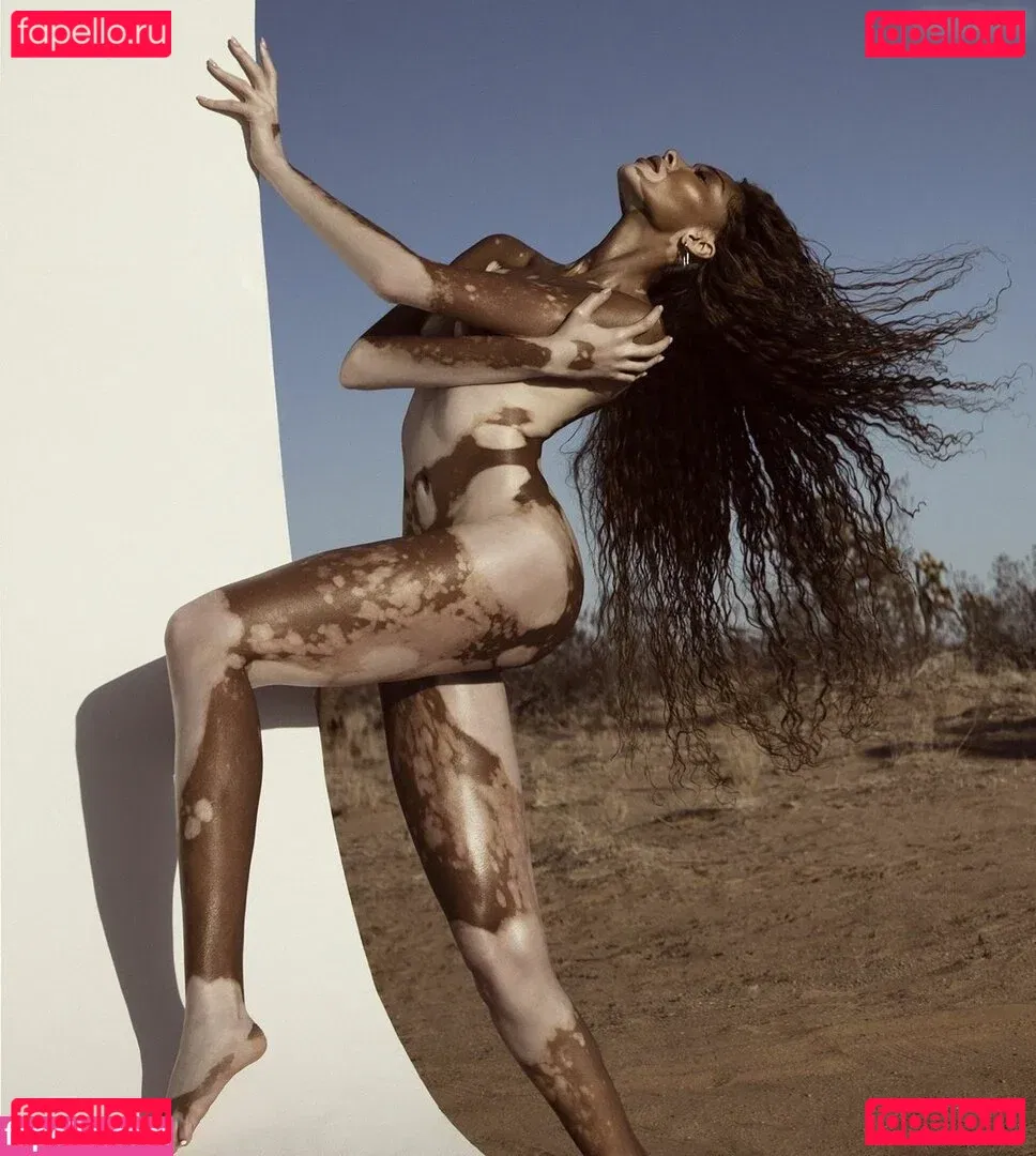 Winnie Harlow Onlyfans Photo Gallery 