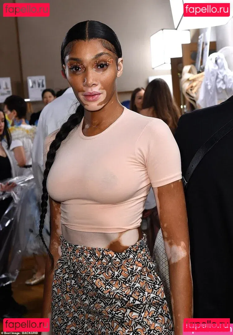 Winnie Harlow Onlyfans Photo Gallery 