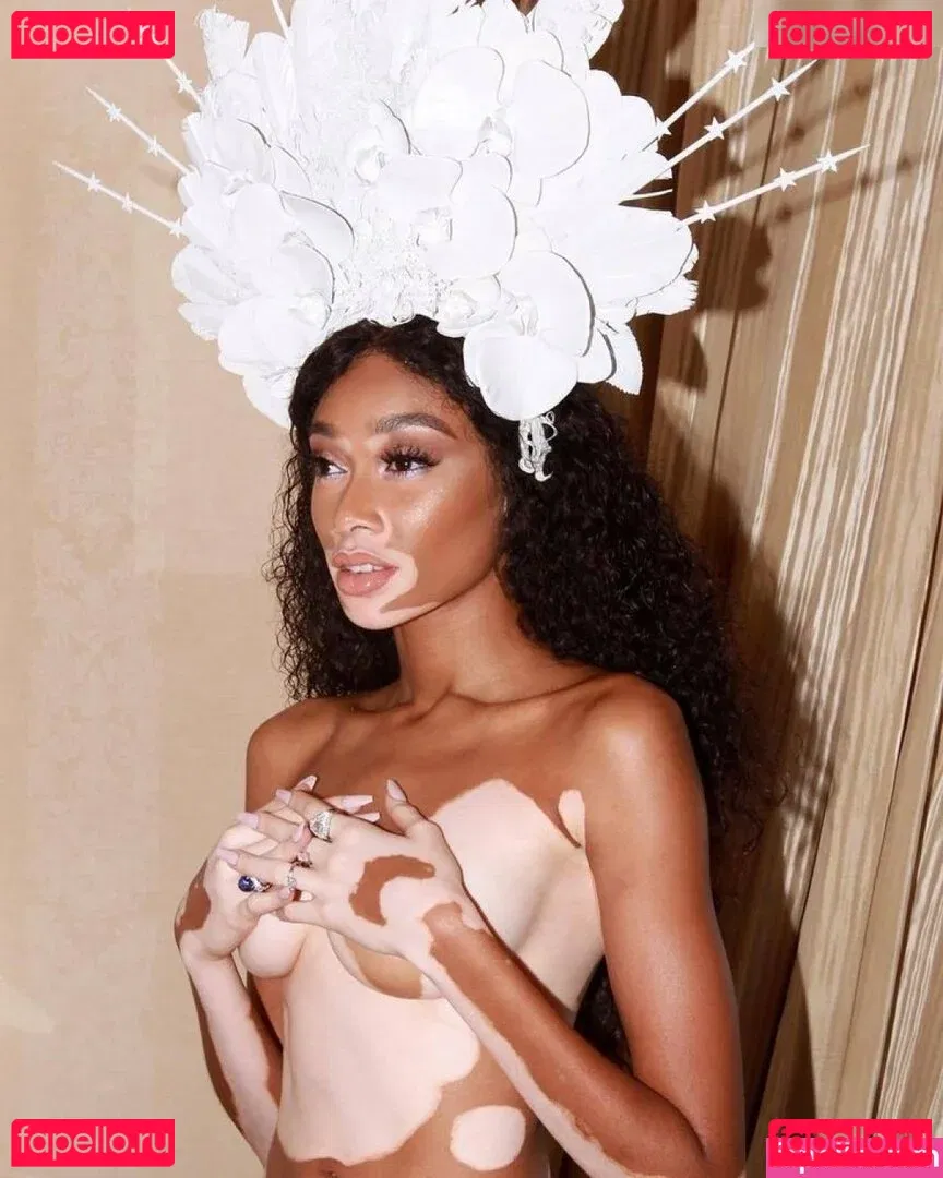 Winnie Harlow Onlyfans Photo Gallery 