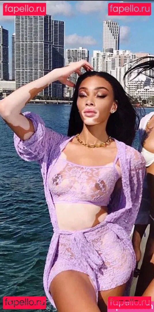 Winnie Harlow Onlyfans Photo Gallery 
