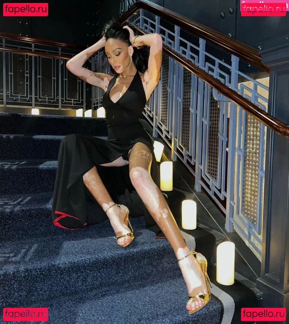 Winnie Harlow Onlyfans Photo Gallery 