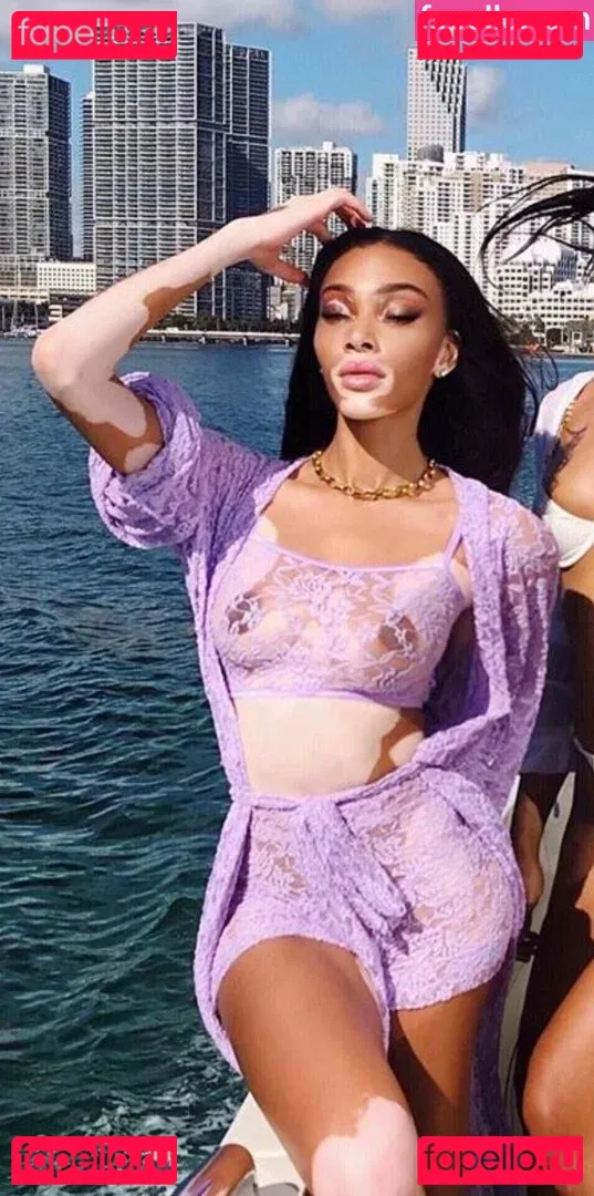 Winnie Harlow Onlyfans Photo Gallery 