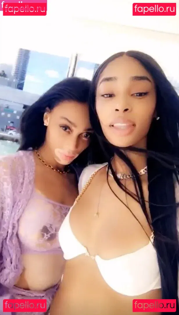 Winnie Harlow Onlyfans Photo Gallery 