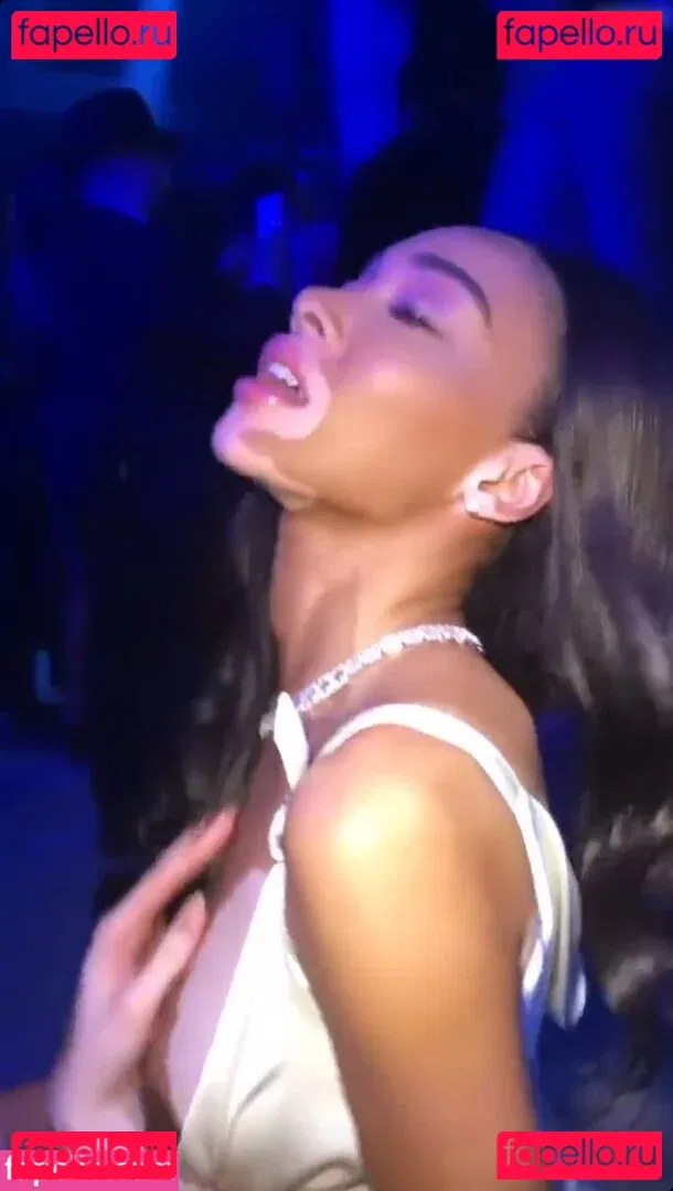 Winnie Harlow Onlyfans Photo Gallery 