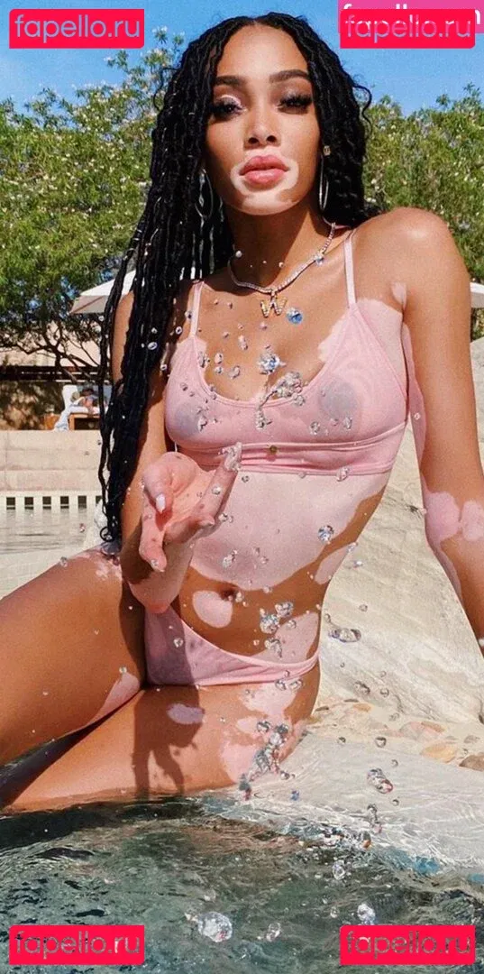 Winnie Harlow Onlyfans Photo Gallery 