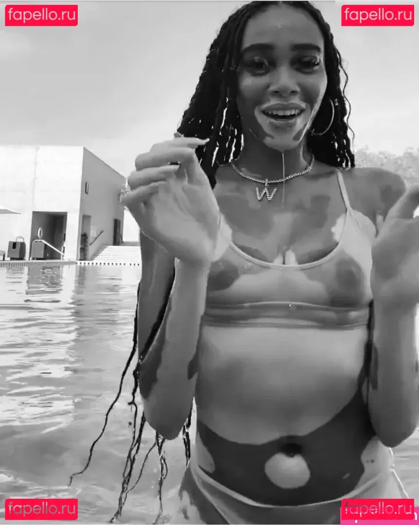Winnie Harlow Onlyfans Photo Gallery 