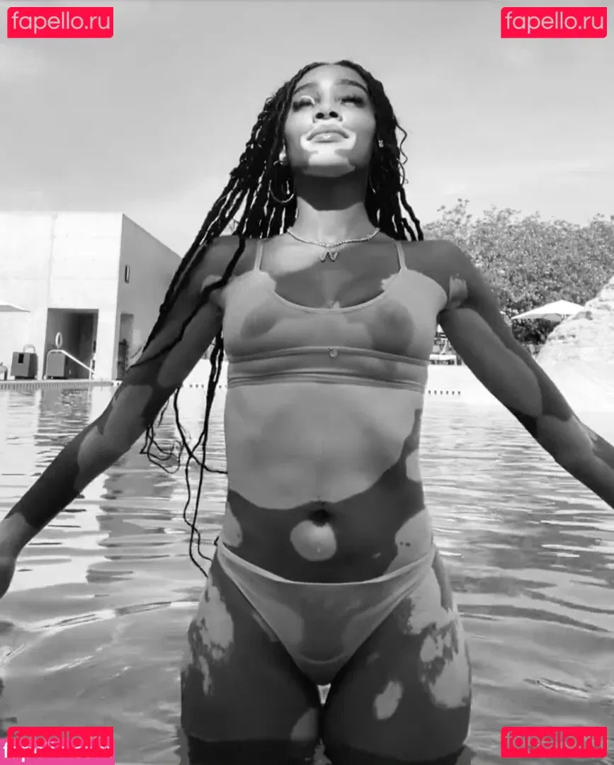 Winnie Harlow Onlyfans Photo Gallery 