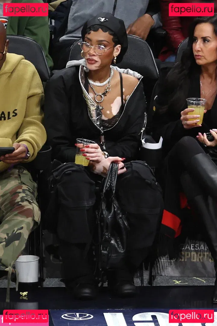 Winnie Harlow Onlyfans Photo Gallery 