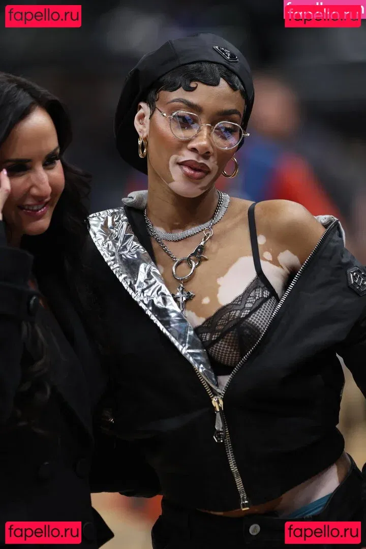 Winnie Harlow Onlyfans Photo Gallery 
