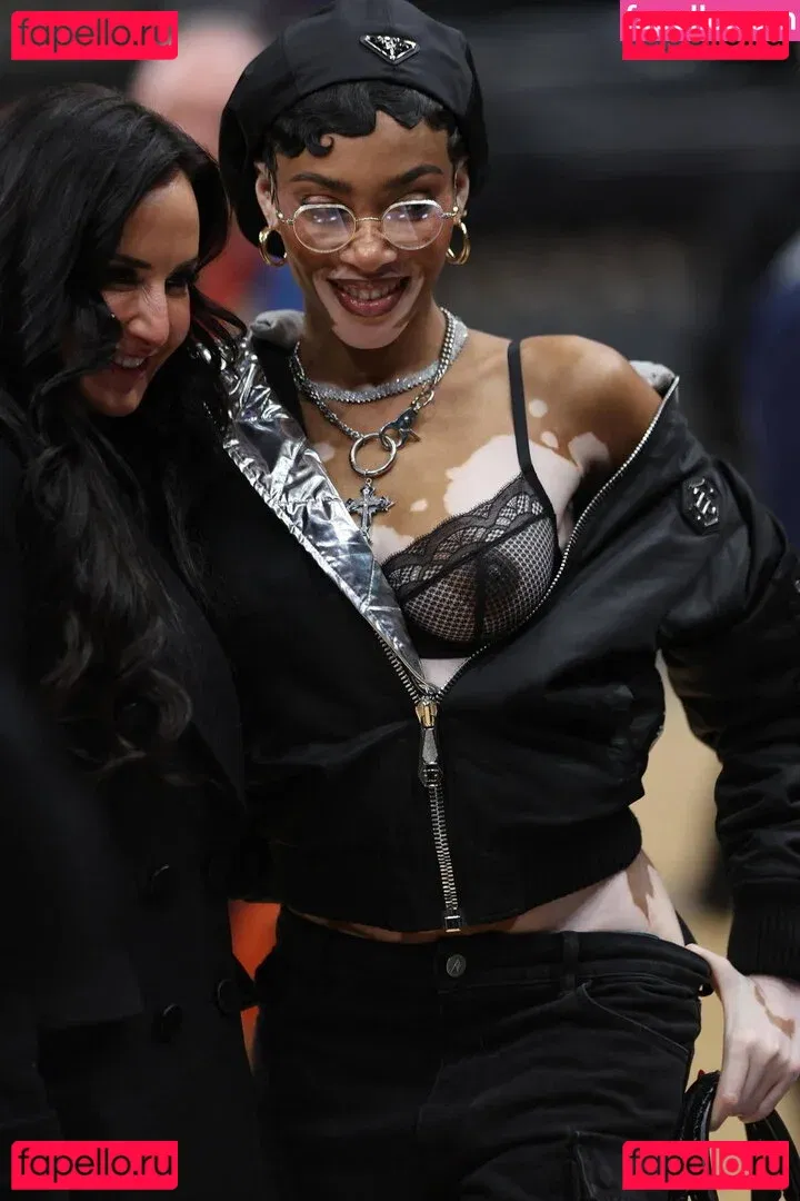 Winnie Harlow Onlyfans Photo Gallery 