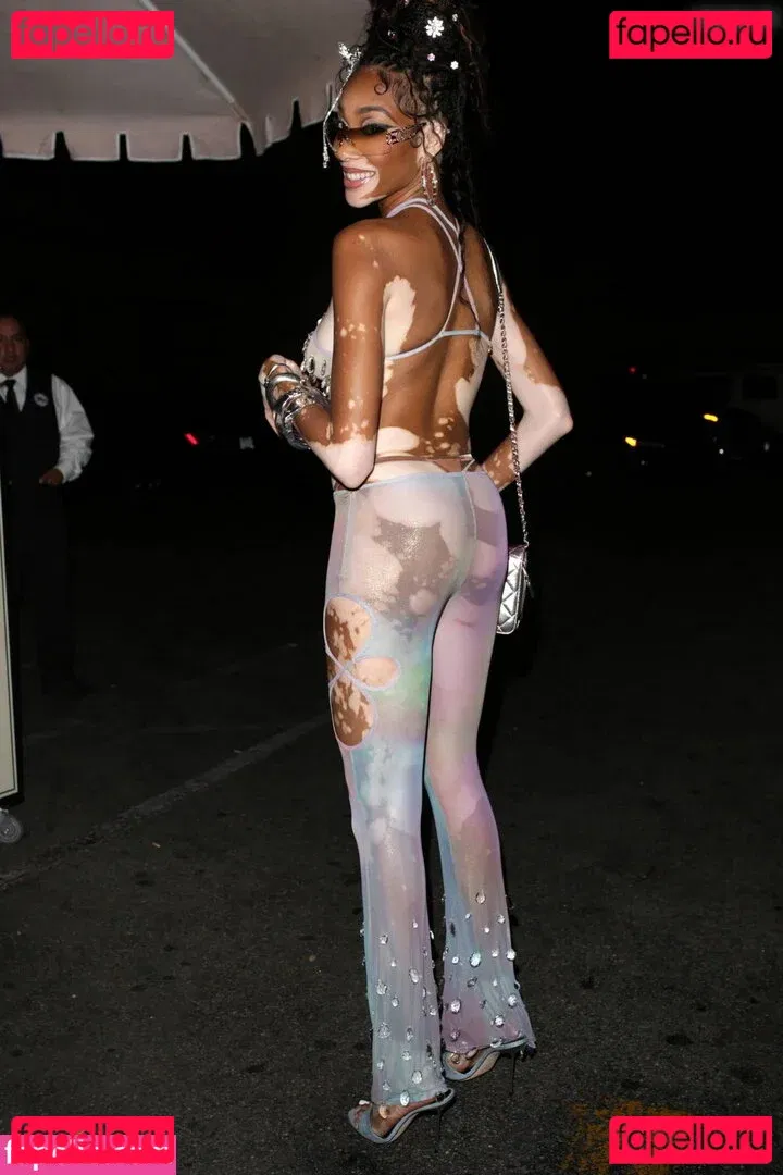 Winnie Harlow Onlyfans Photo Gallery 