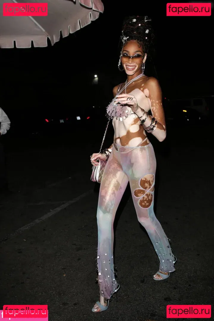 Winnie Harlow Onlyfans Photo Gallery 