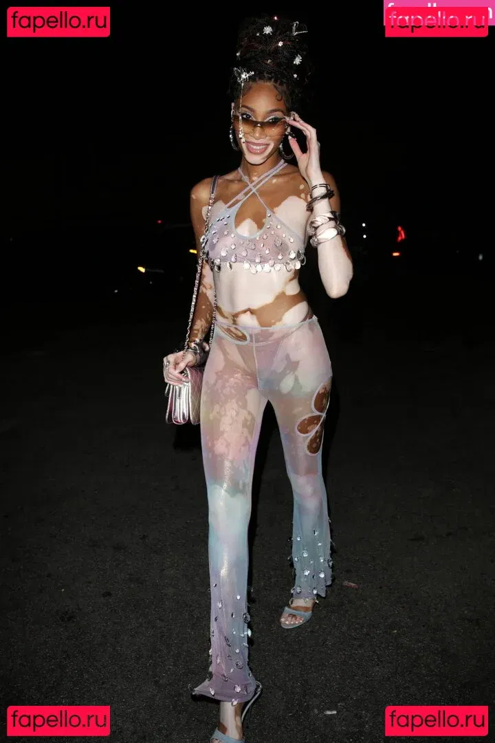 Winnie Harlow Onlyfans Photo Gallery 