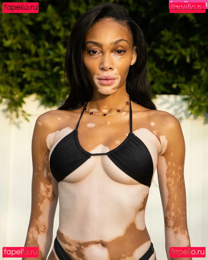 Winnie Harlow Onlyfans Photo Gallery 