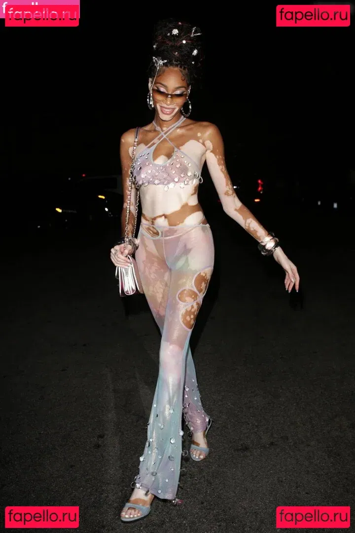 Winnie Harlow Onlyfans Photo Gallery 