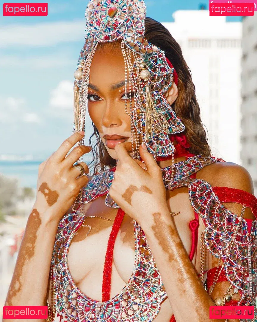 Winnie Harlow Onlyfans Photo Gallery 