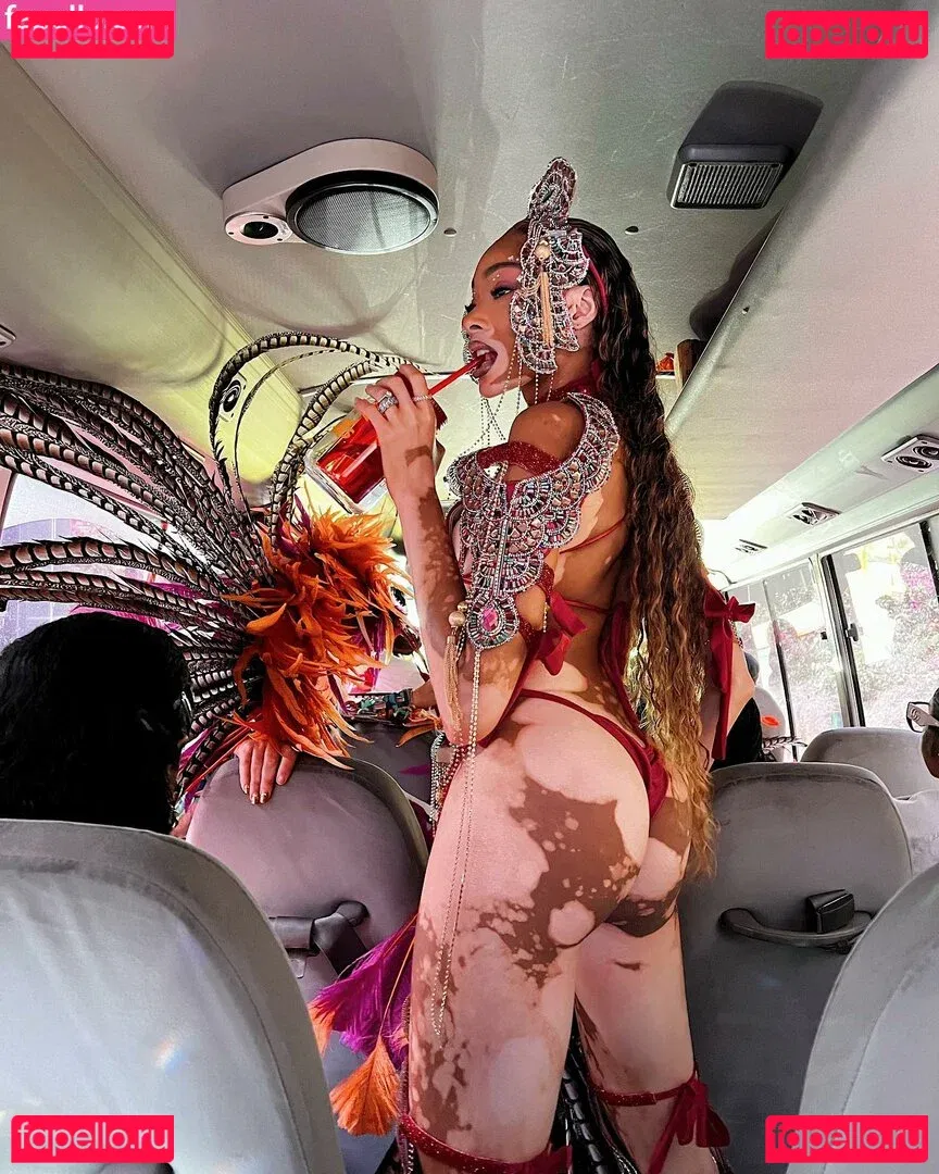 Winnie Harlow Onlyfans Photo Gallery 