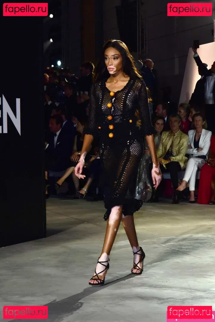 Winnie Harlow Onlyfans Photo Gallery 