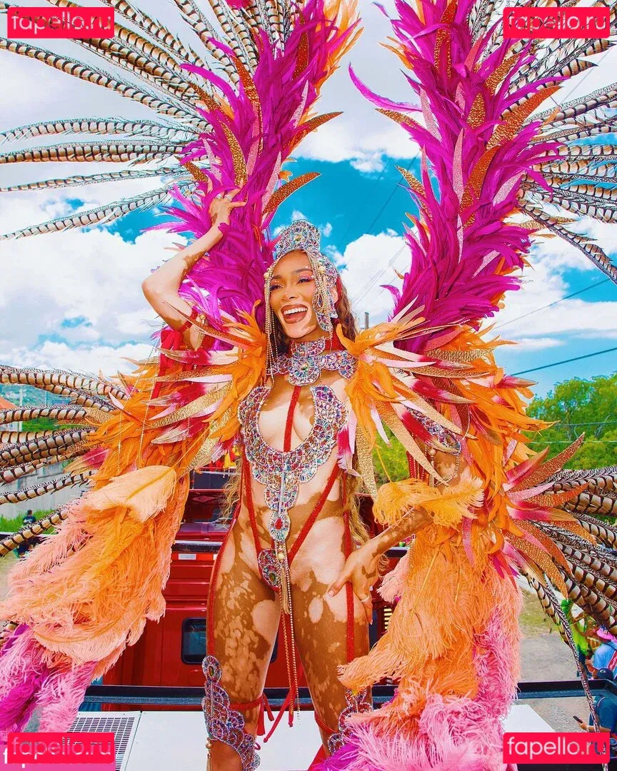 Winnie Harlow Onlyfans Photo Gallery 