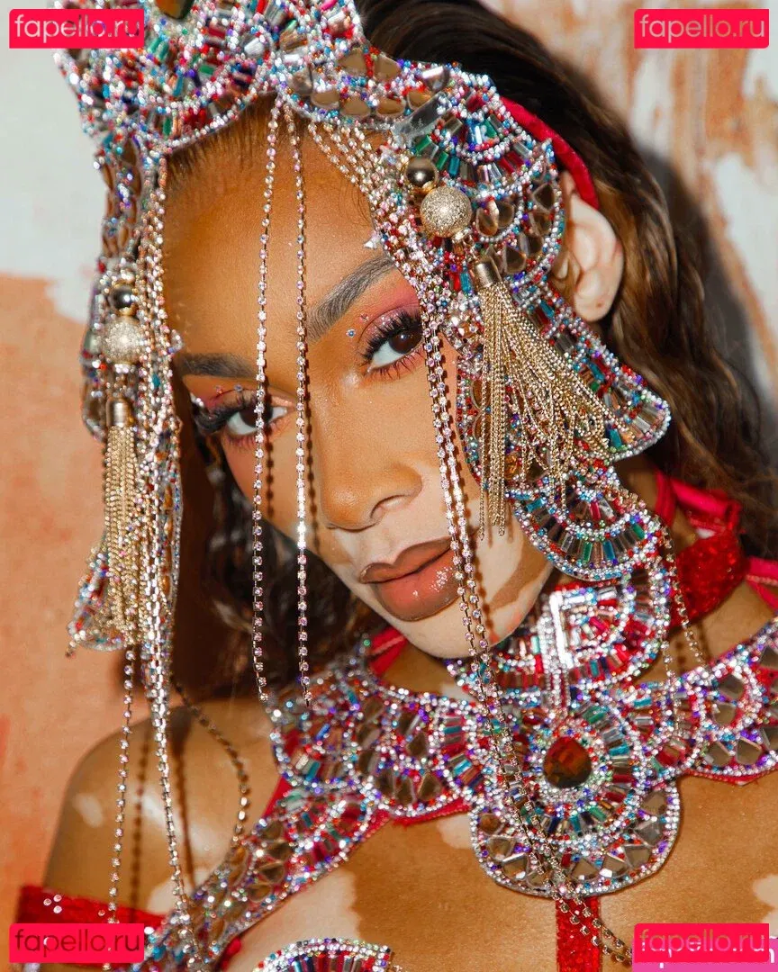 Winnie Harlow Onlyfans Photo Gallery 