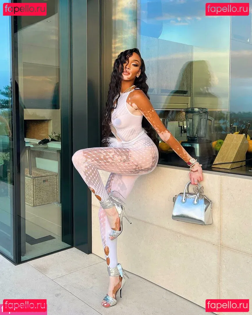 Winnie Harlow Onlyfans Photo Gallery 